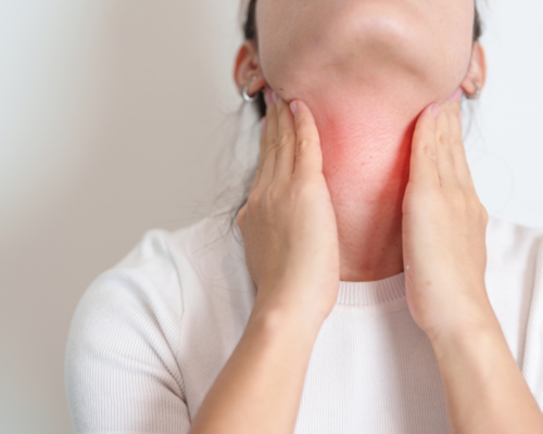 Cường giáp kích thích mệt mỏi sụt cân nhanh