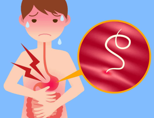 Nhiễm ký sinh trùng gây mệt mỏi sụt cân